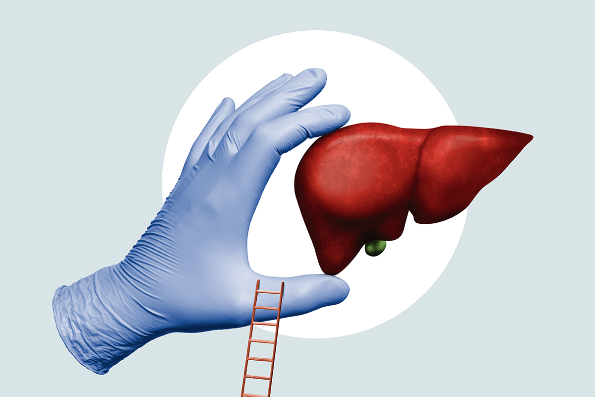 liver transplant