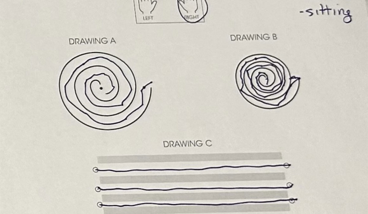 After HIFU treatment