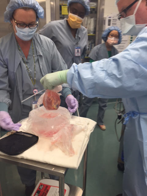 Dr. Pramod Bonde readies the new heart for implantation into the patient. 
